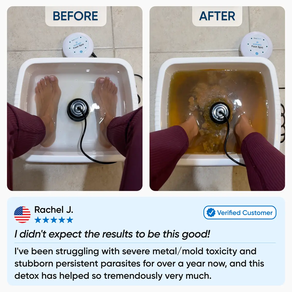 Healifeco Ionic Foot Spa
